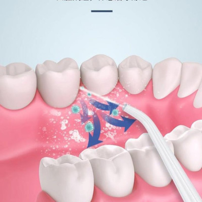 Tăm nước, Máy Tăm Nước Cầm Tay,Tăm Nước Vệ Sinh Răng Miệng Oral irrigator - Sạc USB, Chống Nước, Công nghệ Châu Âu