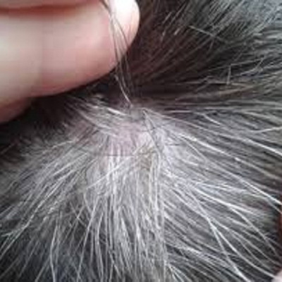 HÀ THỦ Ô ĐỎ MẸ KEN-Loại có thành phần đậu đen xanh lòng giảm nóng trong hộp 500gr
