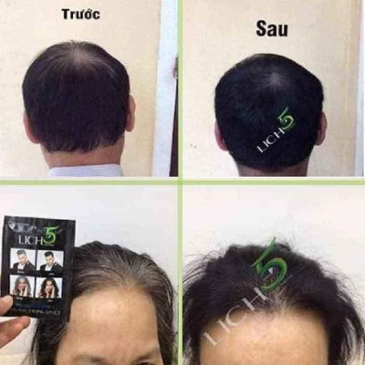 Combo 2 Dầu gội nhuộm tóc thảo dược Lich5 - Lên màu tự nhiên - Sử dụng đơn giản, tiện lợi, mùi dễ chịu