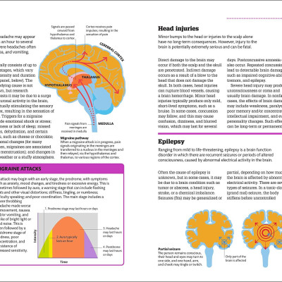 How The Brain Works: The Facts Visually Explained (How Things Work)