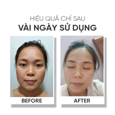 Bộ sản phẩm dưỡng da LÁ HOUSE gồm Toner All Natural,Bông tẩy trang