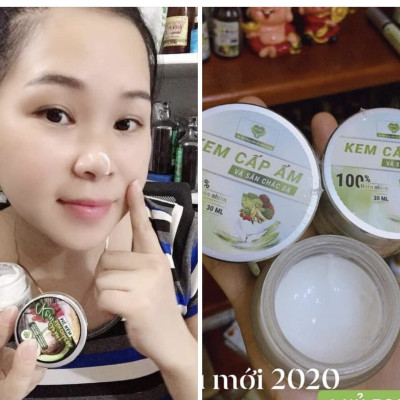 Kem Cấp Ẩm & Săn Chắc Da MẸ KEN 30ml - kem cẩm ẩm cho da