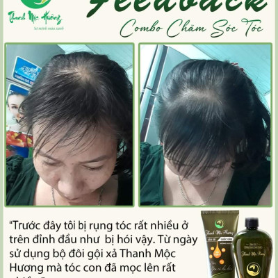 Combo dầu gội & dầu xả Thanh Mộc Hương ngăn rụng tóc kích thích mọc tóc sạch gàu nấm ngứa 350ml