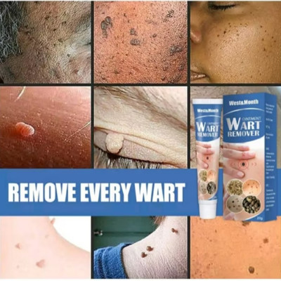 HỘP KEM TRỊ HẾT MỤN CÓC NÚT RUỒI DA THÂM SẠM LOẠI TỐT