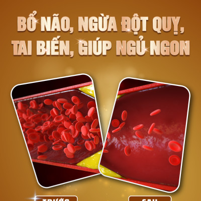 Viên Uống Phòng Ngừa Đột Quỵ, Bổ Não Nattokinase 3000FU Natto Ichou Genki Fami Nhật Bản