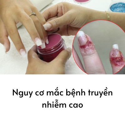 Set 20 Miếng Dán Móng Tay Silicon Nghệ Thuật Nhập Khẩu Hàn Quốc Bellaeve
