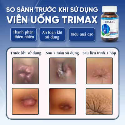 Viên Uống Hỗ Trợ Co Thắt Búi Trĩ Trimax Hủ 30 Viên Nguyên Liệu Từ Thiên Nhiên