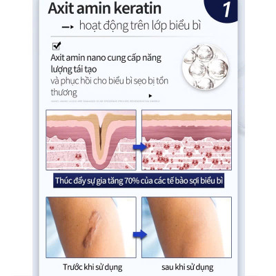 Kem Bôi Xóa Mờ Sẹo Lồi, Sẹo Lõm Lâu Năm, Rạn Da Sau Sinh, Vết Thâm Mụn – Cải Thiện Hiệu Quả Giúp Da Láng Mịn Tự Nhiên