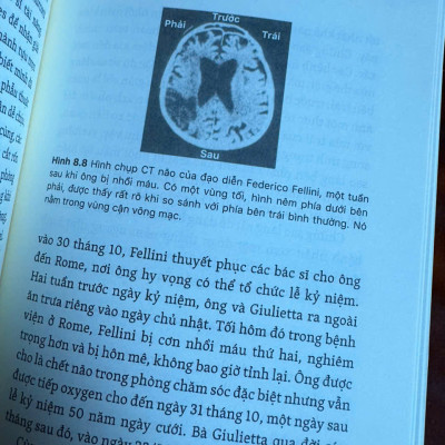 NHỮNG BÍ ẨN CỦA TAY PHẢI VÀ TAY TRÁI – Chris McManus – Phạm Văn Thiều, Phạm Thu Hằng dịch – NXB Trẻ