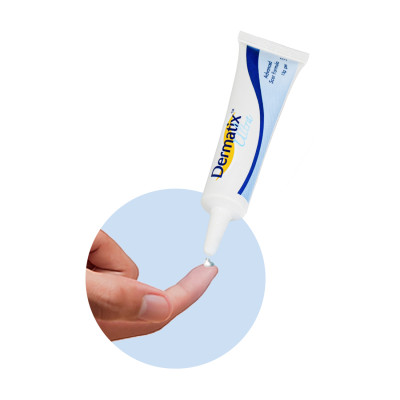 Gel làm mờ sẹo Dermatix Ultra (7g)