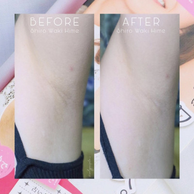 KEM DƯỠNG BAN ĐÊM CHO VÙNG NÁCH  - THƯƠNG HIỆU HIMECOTO - SHIROWAKI HIME NIGHT PACK 