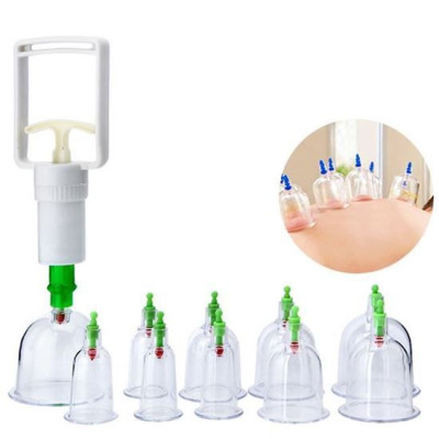 Bộ Dụng Cụ Giác Hơi Không Dùng Lửa 12 Ly - Hàng Nhập Khẩu